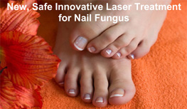 nail fungus